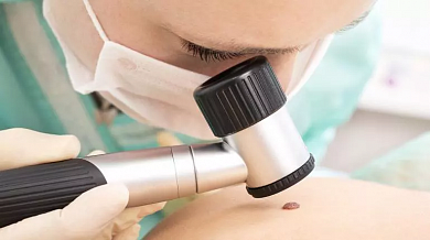 Grupovina Vizim: Pregled specijaliste dermatologije sa dermatoskopijom! Popusti